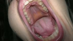 in-depth yawning after the party wmv