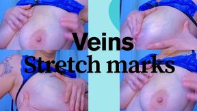 Tits Veins and Stretch Marks Fetish Close-Up
