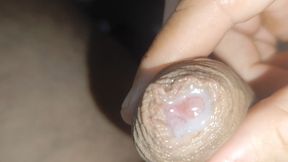 I Have the Largest Ejaculating Phimosis in the World!!