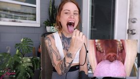 Inside Jasper’s Giant Mouth - Jasper Reed Endoscope Mouth Tour