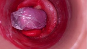 The camera inside the deep pussy records a huge ejaculation with a stuck condom