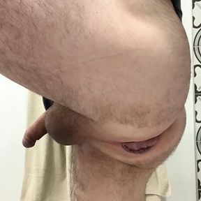 Ass dilatation