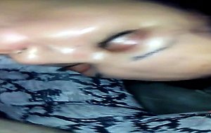 Post op gf smoking bj