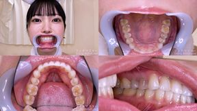 Ten Michihisa - Watching Inside mouth of Japanese cute girl