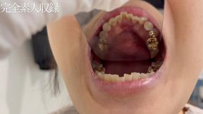 Amateur , Oral Fetish – It’s a Miracle to See This. A 20-Year-Old with Gold Teeth, Completely Recorded in Full Detail.