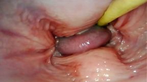 AMAZING INTERNAL POV  CAMERA INSIDE HER PUSSY WHILE I FILL HER WITH CUM