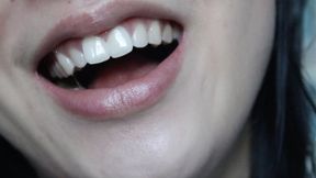 Aurora's Teeth Adventures