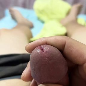 Penis after phimosis surgery