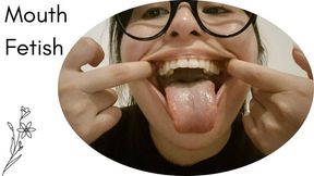 Inspecting my mouth and my crooked teeth