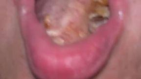 Rose Eats Chicken Bites
