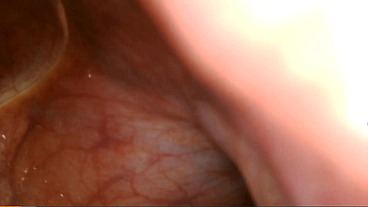 Internal POV: Micro-Camera Journey Inside My Body