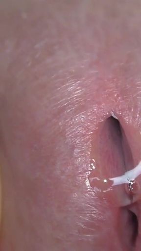 Urethral Interior Views of the Glans