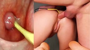 Older anal queen gets deep fuck and creampie