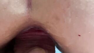 sexy Stepmom Anal. Anal Chubby. Chubby Amateur Anal. STANDING ANAL. Gaping asshole. Gigantic butt anal.