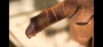 penis burning
