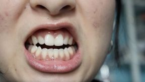 Aurora Teeth Please You 2