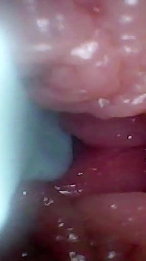 Endoscope Camera Records My Wife's G Spot. Educational Video Close up