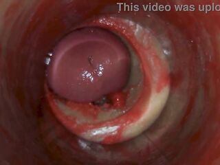 Camera Inside Deep Pussy Captures Huge Ejaculation of Sperm ASMR