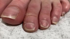 LONG TOES AND TOENAILS - SD
