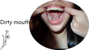 Dirty mouth