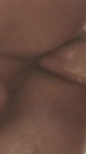 Gaping Anal Prolapse Overflow - Rosebud Pulsing Wide Open