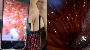 Swallowed Camera Journey, endoscopic POV Experience