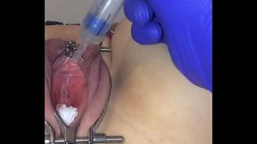 Female catheter tutorial