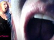 Vore Endoscopy