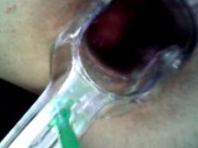 Deep look inside cum filled ass with endoscope