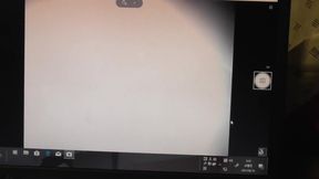 I looked into the hole in my butt with an endoscope.