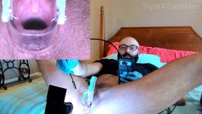 Gyno Torment at Teleheath Doctor Visit, Medfet Gynecology Roleplay