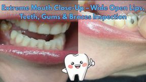 Extreme Mouth Close-Up Teeth, Gums & Braces Inspection