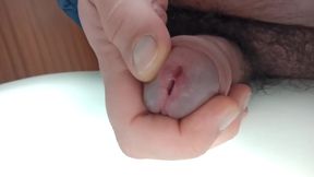 Peehole Enlargement While Peeing