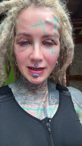 This Is Day 4 After My Boobs Surgery and My Body Is Healing