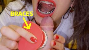 Braces HERBST cock-biting with braces-model, CUM on teeth