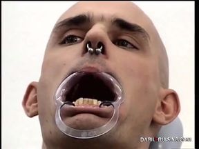 Trapped in the dentist chair