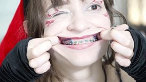 Christmas Girl Showing Her Braces Close