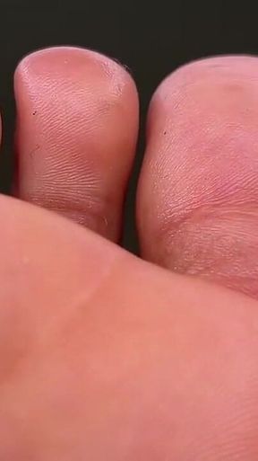 Wrinkly Toes up-close