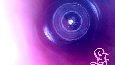 Endoscope Journey into My Deepest Intestines