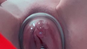 I wedge a speculum in my pumped pussy and become a piss fountain