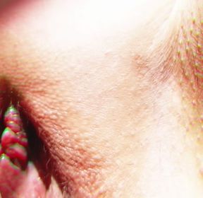 Getting sun on my pussy