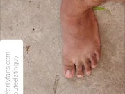 Amputee guy walking with crutches