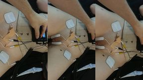 throwback thursday to my owner using electricity to make my legs move out of my control! (and hurting me in the process of co...