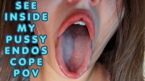 Endoscope POV Close-Up – Mouth Play, Intimate Teasing & Giantess Fantasy