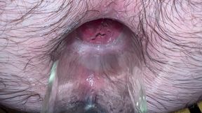 Insert the jar into the anus