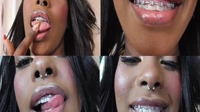 Ebony Teeth Brace Fetish! wmv