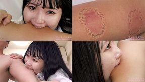 Kurumi - Biting by Japanese cute girl part1 bite-212-2 - wmv