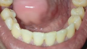 Look at my mouth and my teeth.