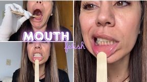 Mouth Examination with a Tongue Depressor