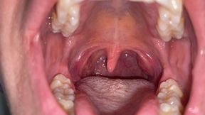 Giantess Uvula Vore Showing